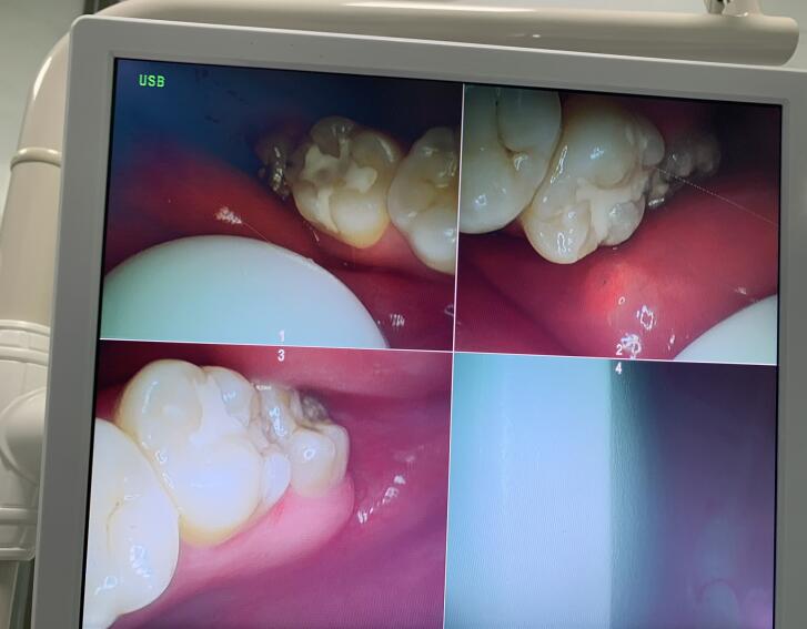 QQ截图20210504110218
